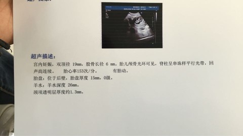 journal_insert_pic_480078928