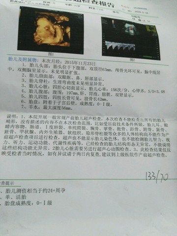 journal_insert_pic_480017149
