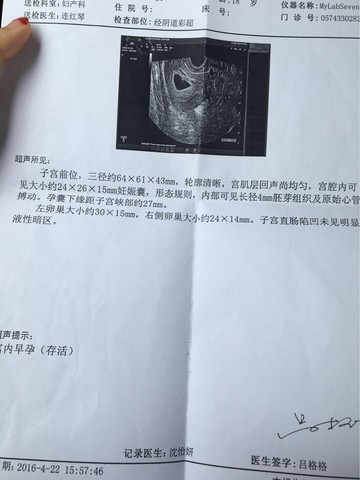 journal_insert_pic_480428375
