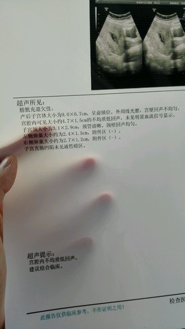 journal_insert_pic_480488732