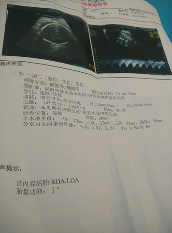 journal_insert_pic_481012270