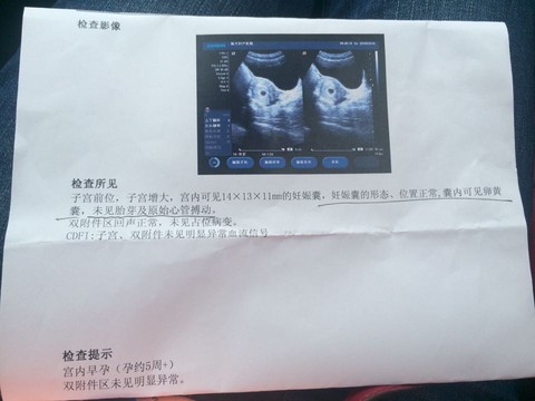 journal_insert_pic_485711095