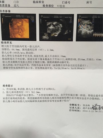 journal_insert_pic_485381063