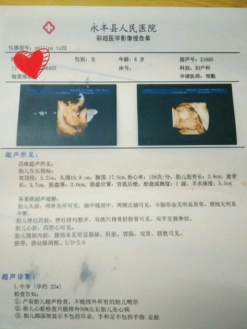 journal_insert_pic_486005597