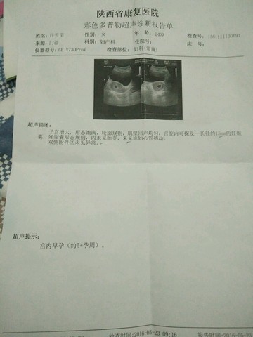journal_insert_pic_486386249