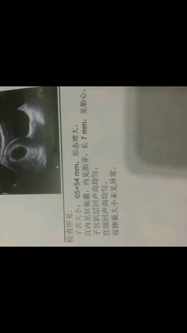 journal_insert_pic_486510830