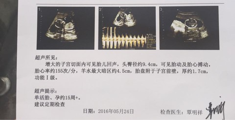 journal_insert_pic_487631275
