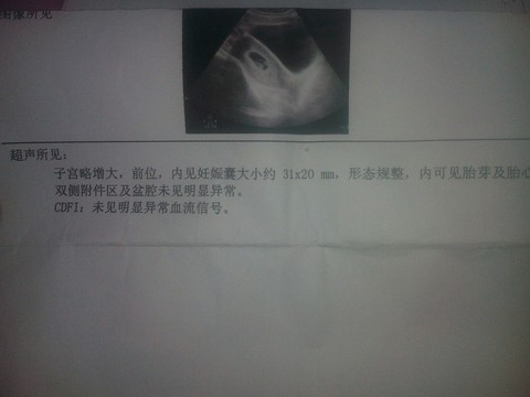 journal_insert_pic_488861657