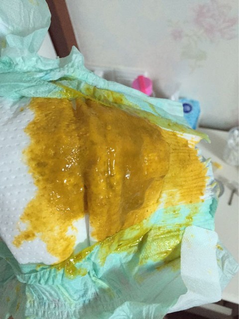 宝宝拉稀