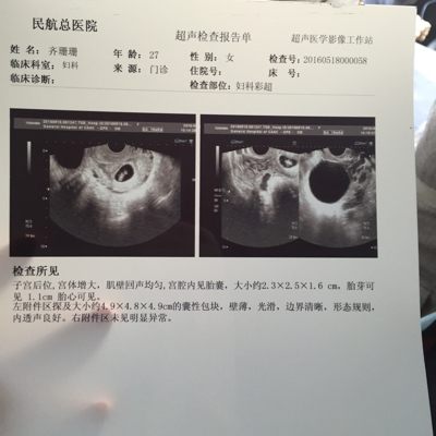 journal_insert_pic_494226005