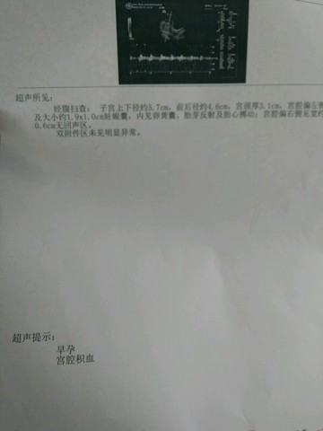 journal_insert_pic_495239020