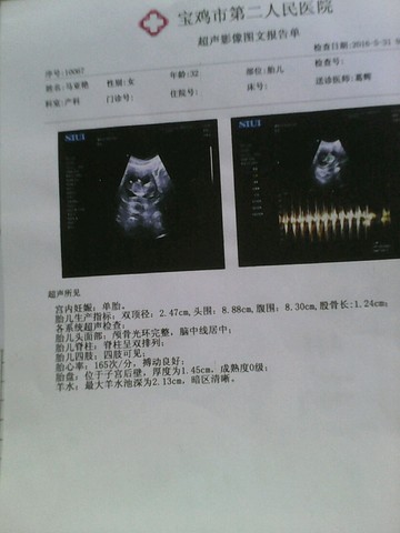 journal_insert_pic_494727817