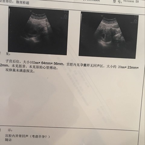 journal_insert_pic_495112614
