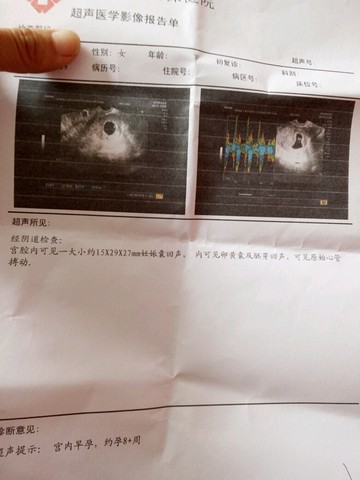 journal_insert_pic_495848568
