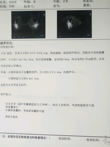 journal_insert_pic_496885599