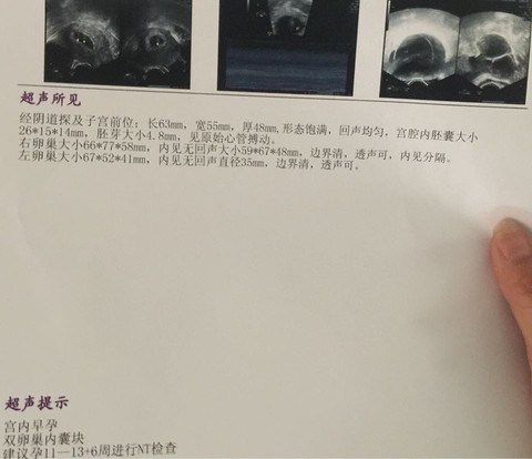 journal_insert_pic_499517589