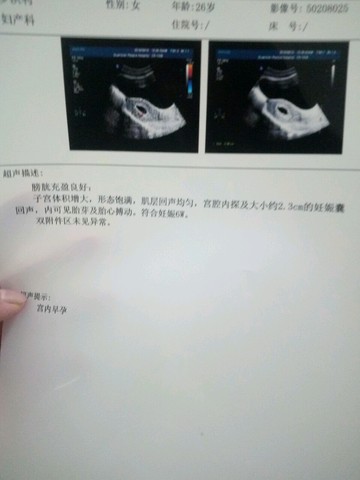 journal_insert_pic_502284161