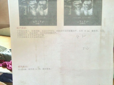 journal_insert_pic_503116895