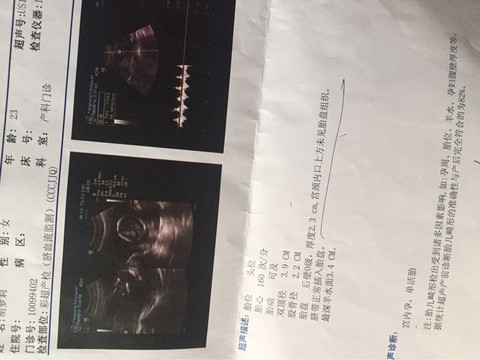 journal_insert_pic_503018820