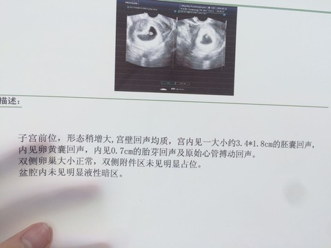 journal_insert_pic_505185712