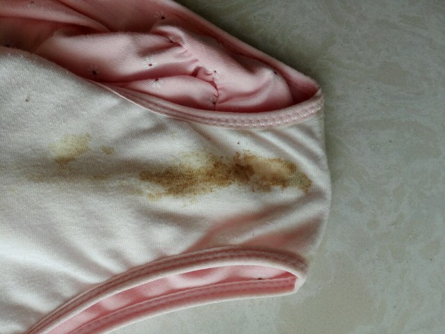 孕22周,内裤上有类似于褐色的分泌物痕迹.有图,慎点.