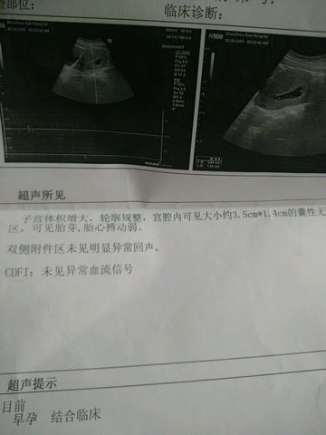 journal_insert_pic_510622988