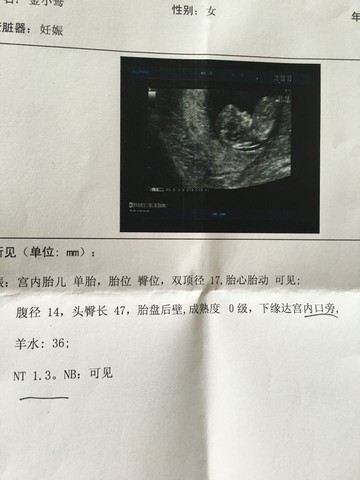 journal_insert_pic_512164066