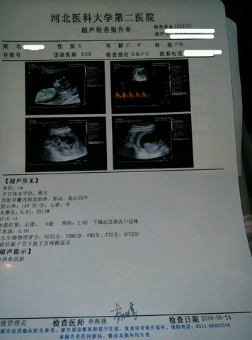journal_insert_pic_513741640