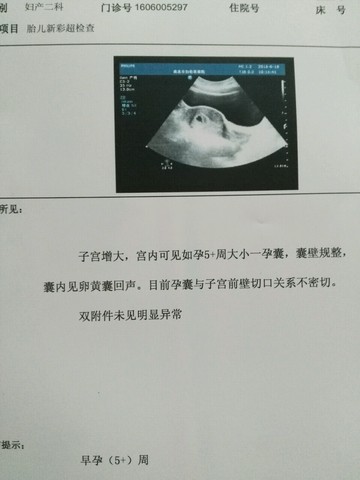 journal_insert_pic_514293598