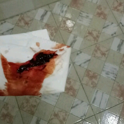 像来月经一样流血上厕所还有小血块?有没有这种情况还能保胎成功的?