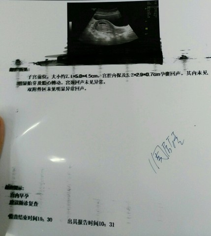 journal_insert_pic_517151175