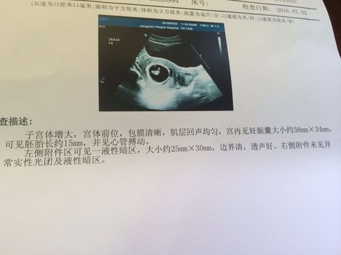 journal_insert_pic_519892029