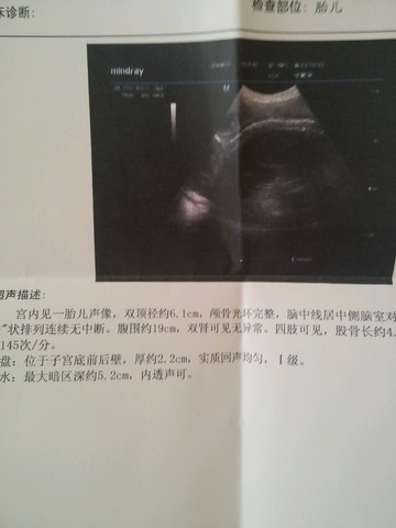 journal_insert_pic_520523941