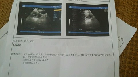journal_insert_pic_522033388