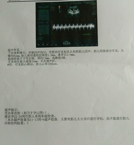 journal_insert_pic_522969337
