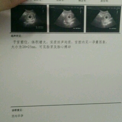 孕囊圆形的图片图片