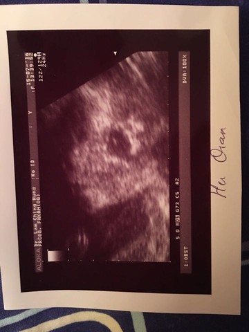 journal_insert_pic_531364083