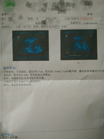 journal_insert_pic_532525374