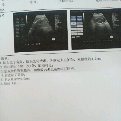 journal_insert_pic_535972983