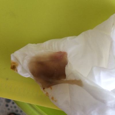 怀孕期 推荐回答                     有些血丝的话是因为先兆流产