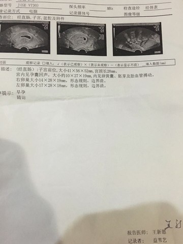 journal_insert_pic_536995491