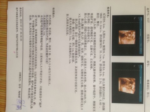 journal_insert_pic_538776210