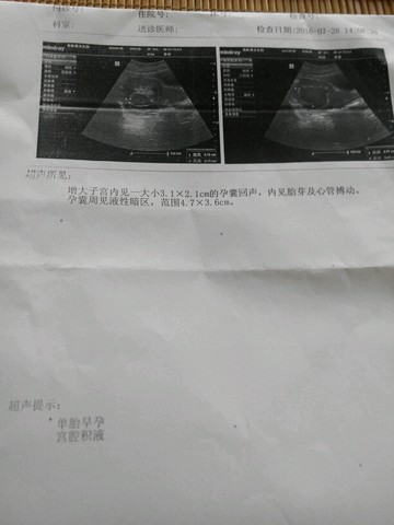 journal_insert_pic_539659439