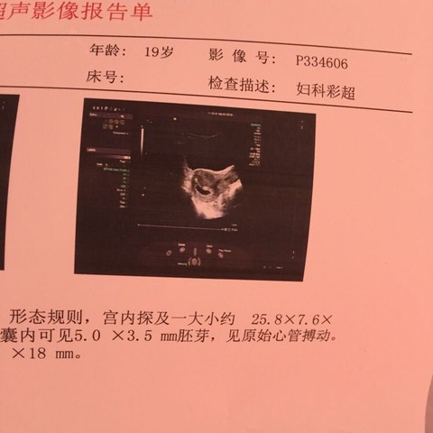 journal_insert_pic_542257895
