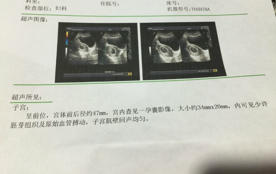 journal_insert_pic_543479145