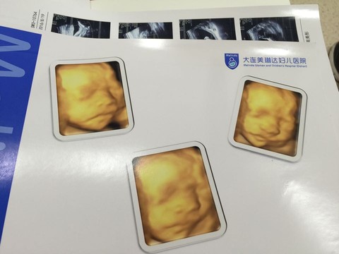 journal_insert_pic_554435537