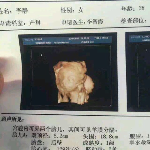journal_insert_pic_563085307