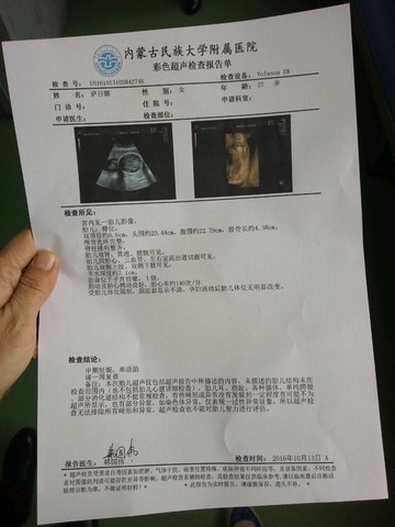 journal_insert_pic_590273599