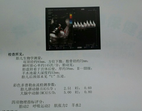 journal_insert_pic_592937971