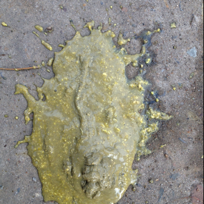 宝宝之前流鼻涕打喷嚏,然后就开始拉肚子了,吃了药,也贴了肚脐,不见好